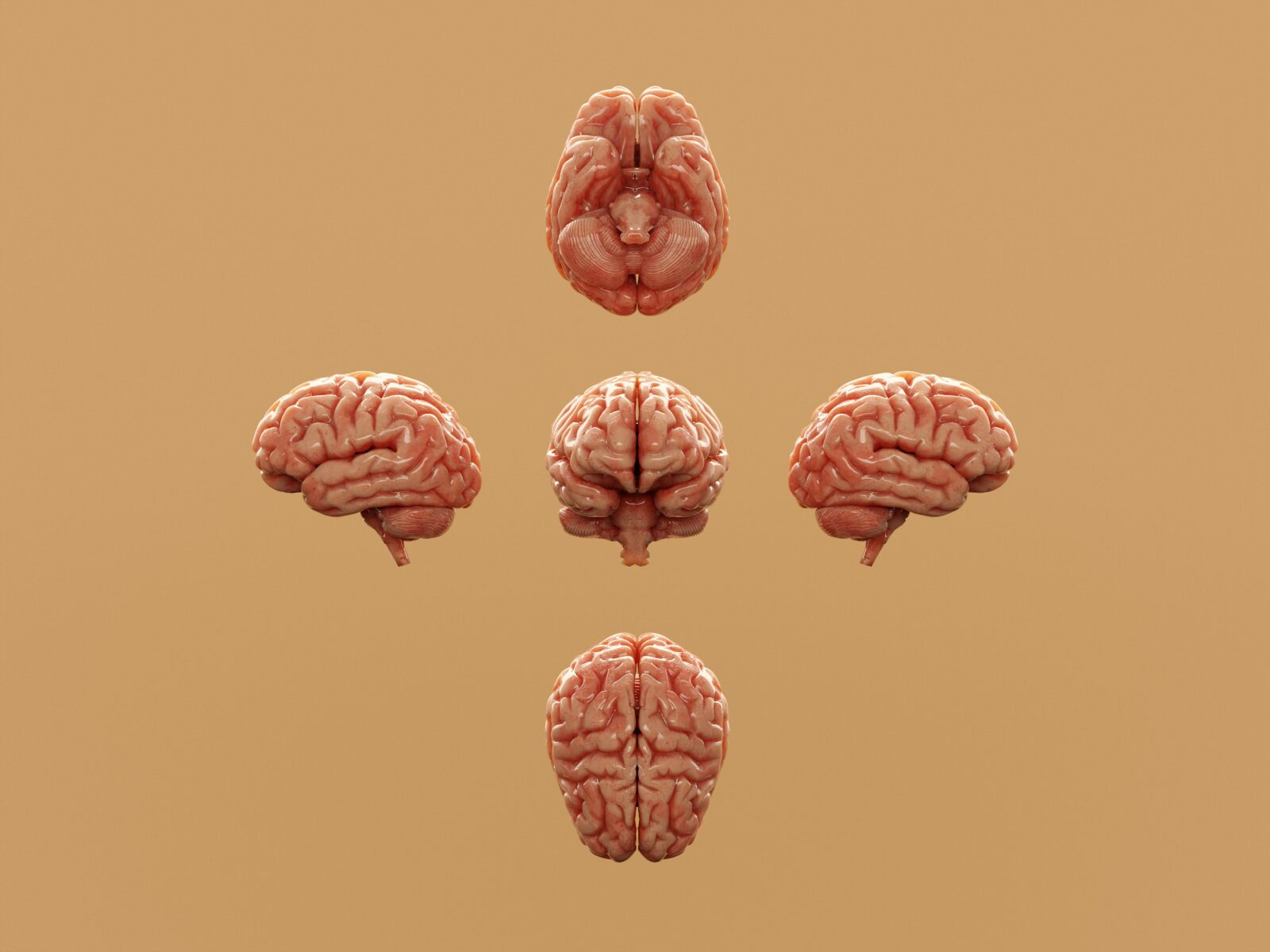 Five brains shown from different angles