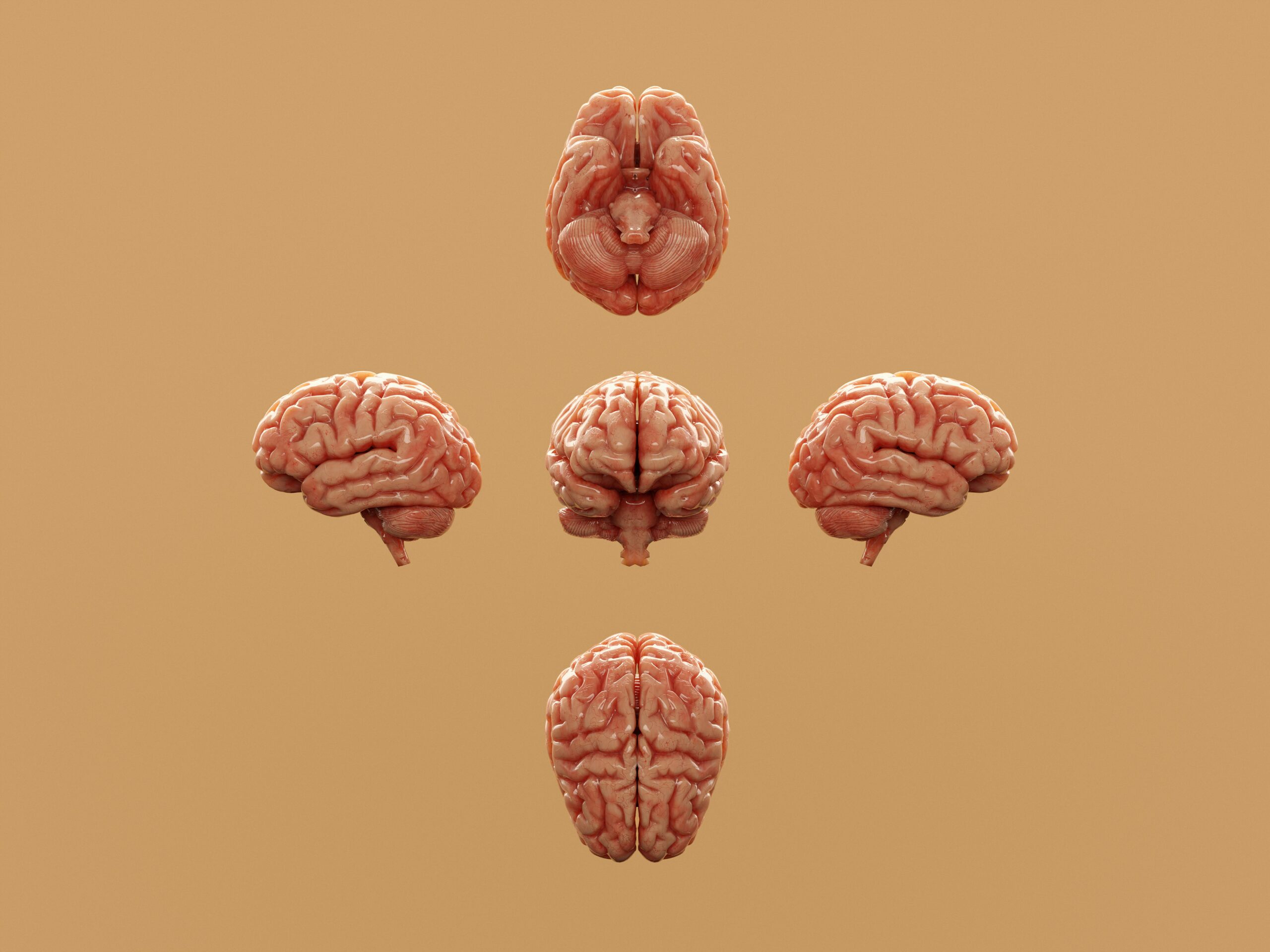 Five brains shown from different angles